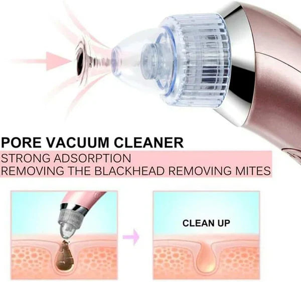 Kemei Blackhead Sucker Machine